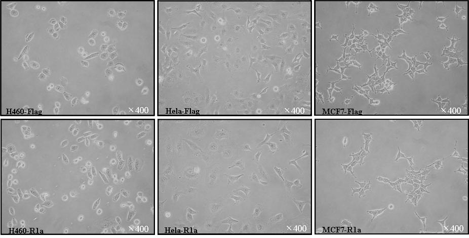 Lig4 결합 인자 RIa 의 과발현에 의한 세포의 형태 변화.