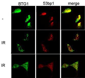 BTG1 과 53BP1 의 in vivo interaction을 현미경으로 관찰함. 이미지를 merge 하여 yello 로 나타나는 부위가 BTG1 과 53BP1 이 colocalize 하는 것을 나타냄.