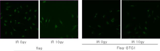 53BP1 의 foci formation. BTG 가 과발현 된 세포에서 (right panel) 53BP1 의 foci intensity 가 감소함. 신호의 발생이 BTG 에 의해 줄어듦.