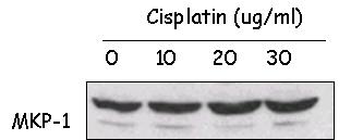 항암제인 cisplatin에 처리 농도에 따른 MKP-1의 발현정도의 변화 확인
