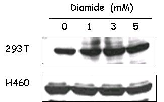 Diamide에 의한 MKP-1의 발현정도의 변화