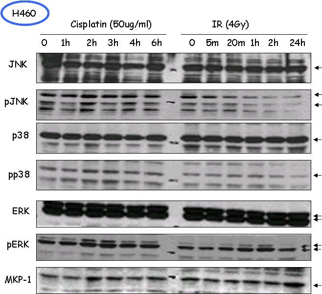 항암제 cisplatin과 방사선에 의한 MAPK signaling의 변화 정도 확인.