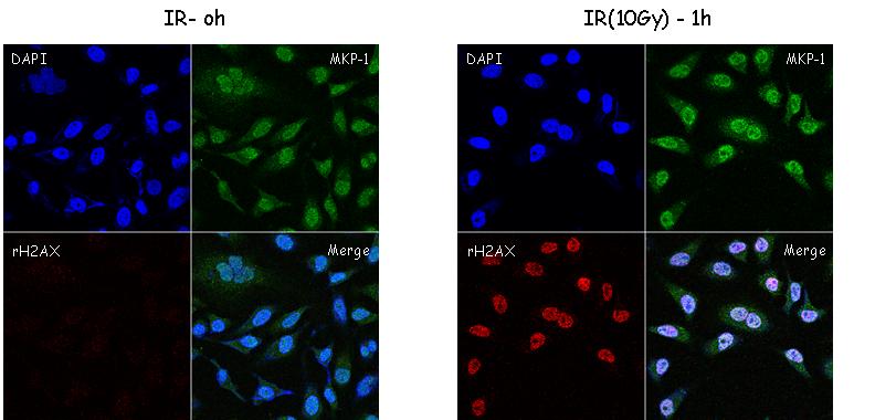 immunofluorescence - 방사선 조사 시 MKP-1과 gamma H2AX의 localization.