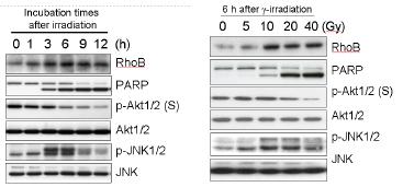 감마선 처리시의 Jurkat T 세포에서의 RhoB 유전자의 발현 변화