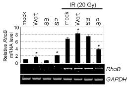 감마선에 의한 RhoB 증가에 중요한 세포내 신호전달계 탐색