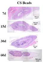 생체내 삽입 후, 7, 15, 30, 60일째 회수된 키토산 비드형 지지체의 H&E 염색 사진 (magnification: x40).