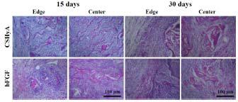 생체내 삽입 후, 15, 30일째 회수된 키토산/히알루론산 비드형 지지체의 H&E 염색 사진 (magnification: x400).