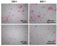 Ultrasonic homogenizer를 이용한 Emulsion-droplet coalescence 방법으로 제조된 키토산 입자의 현미경 사진.