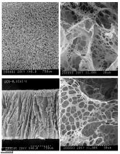 부탄올을 혼합하여 제조한 collagen 혼합 chitosan scaffold 모습. 위; 표면 사진, 아래: 단면 사진
