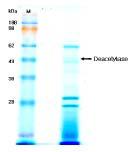 SDS-PAGE (10% acrylamide gel)