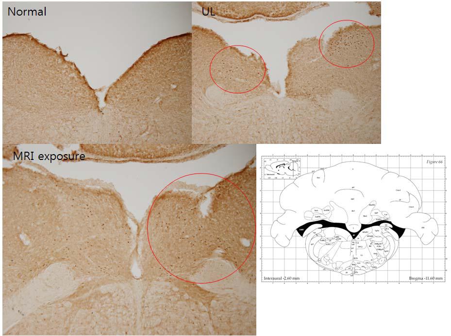 Unilateral Labyrinthectomy군에서 MVN에 등에서 발현된 결과