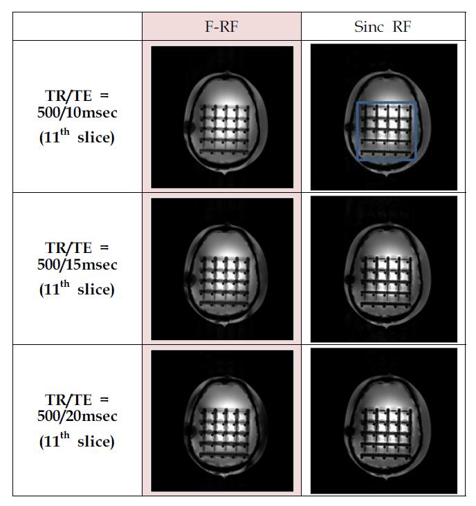 초고자장(7.0T) Sinc RF pulse와 F-RF pulse에 대한 in-vivo 영상 (GEMS 시퀀스)