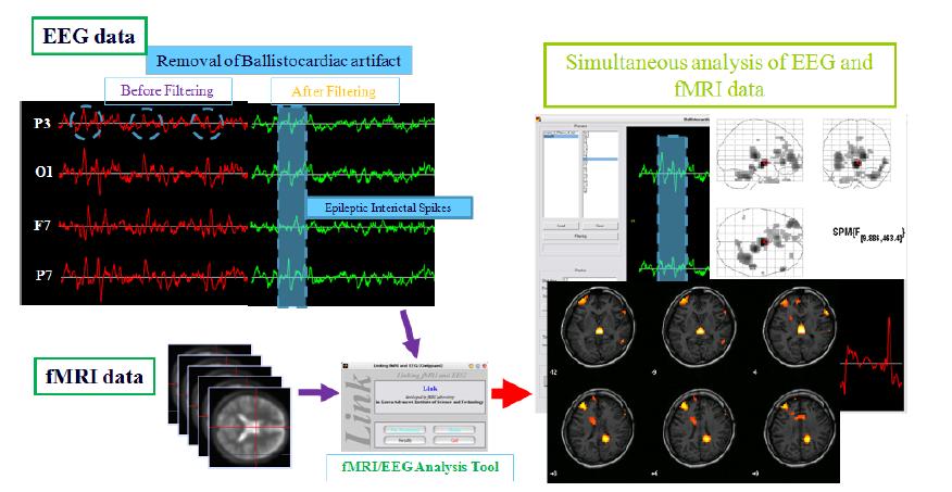 EEG-fMRI 연동실험의 결과 분석을 위한 툴
