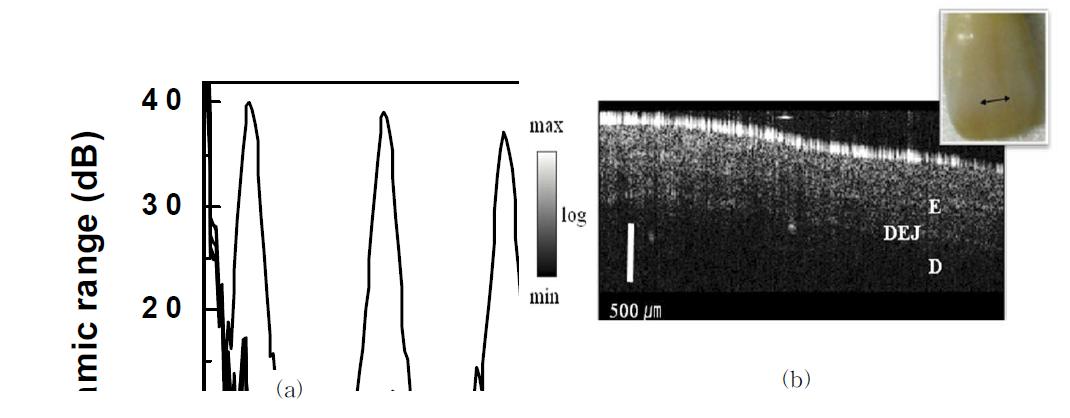 (a) 다양한 optical-length차이에 따른 측정된 axial point. (b) 사람 치아 표본의 OCT 이미지.