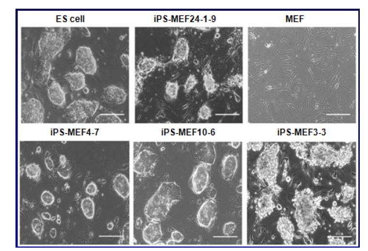 Generation of iPS Cells from MEF Cultures