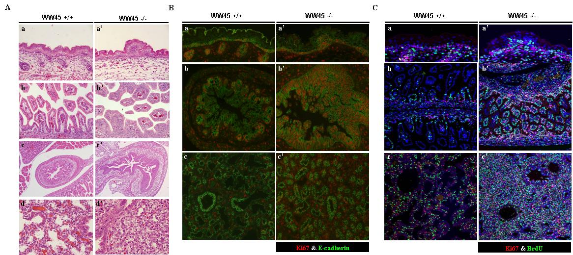 WW45-/- epithelial cells에서의 hyperplasia.