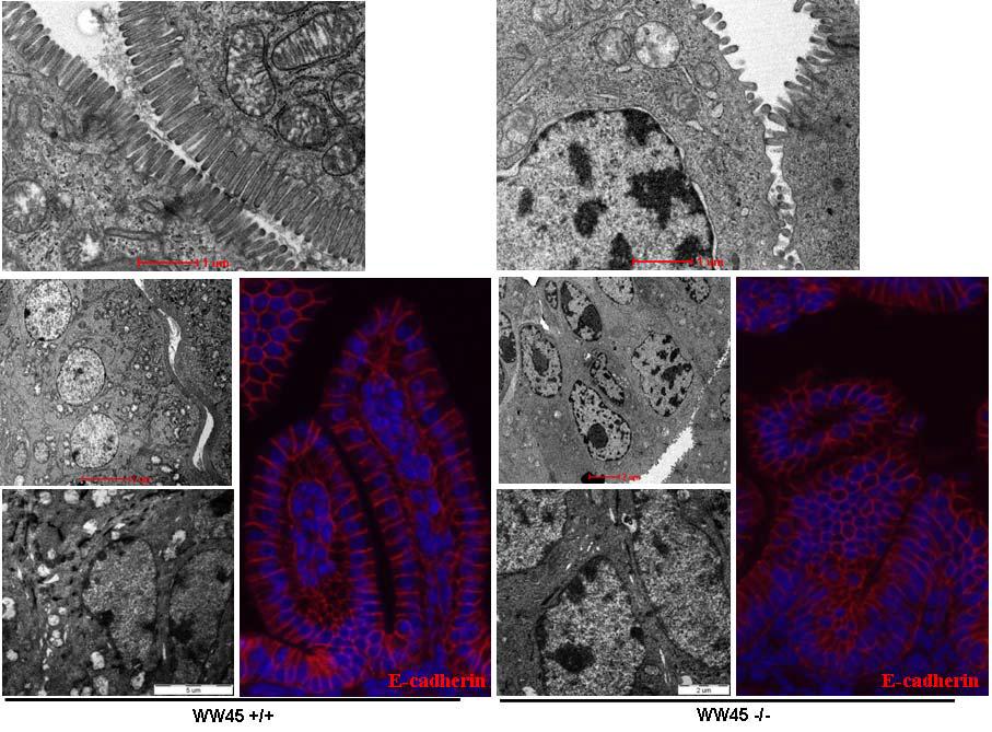 Immature differentiation in WW45-/- epithelia.