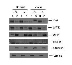 keratinocyte 분화시 MST1 신호전달의 활성화.