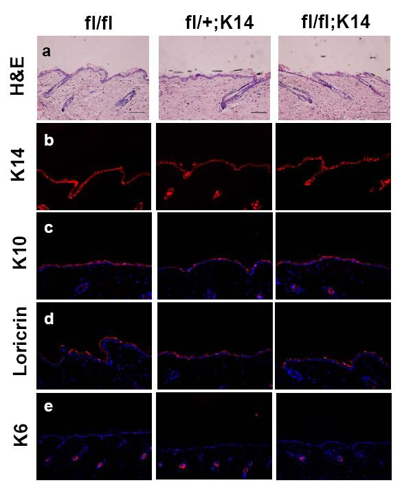 Normal homeostasis and development in WW45 absent skin epithelium.