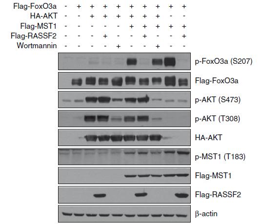 세포 내에서 과발현된 RASSF2는 MST1에 의한 FoxO3의 활성화를 막는다.