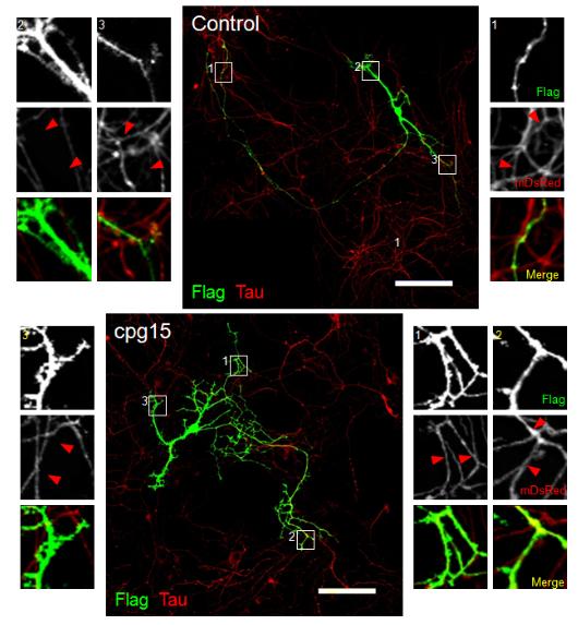 Neuritin transfection한 hippocampal cultured neuron은 axon (Tau)의 길이가 증가됨을 확인함. Immunocytochemistry. 좌우의 그림은 각 숫자에 해당되 는 그림을 확대한 것임.