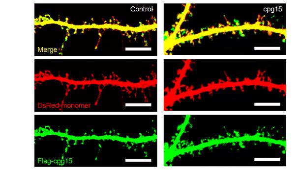 neuritin transfection한 hippocampal cultured neuron 의 spine 형태의 변화를 immunocytochemistry로 조사함.
