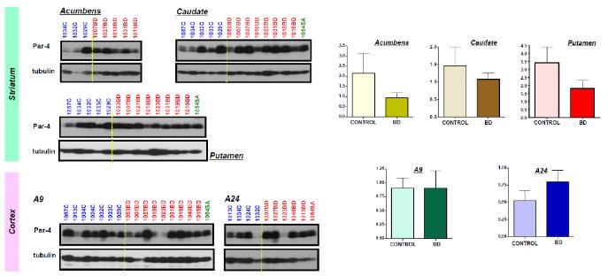 양극성 조울증 환자의 사후 뇌시료의 striatum에서 Par-4의 단백질 양이 감소하는 경향을 보임
