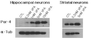 VPA의 농도 의존적인 Par-4 단백질의 발현 증가. VPA를 각 농도별로 24시간 처리한 후 Par-4의 발현이 농도 의존적으로 증가함을 확인 함.