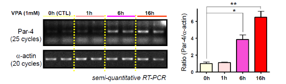 VPA의 장기적 처리에 의한 Par-4 mRNA의 전사증가.
