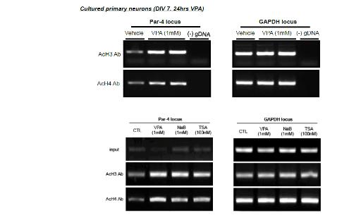 VPA에 의한 Par-4 promoter region에서의 histone modification.