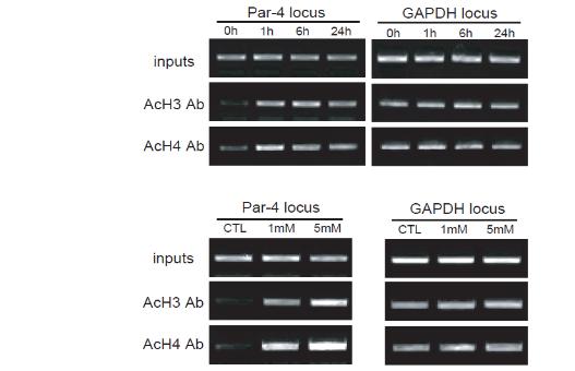 시간대별, 농도별에 따른 Par-4 promoter region에서의 hisone modification.