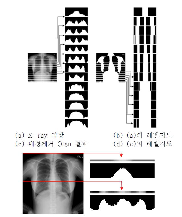 X-ray 영상의 1번째, 300번째 라인의 레벨지도