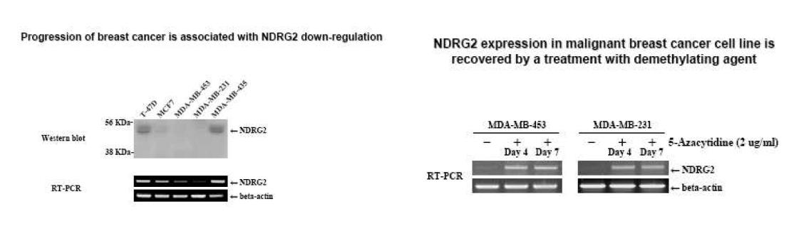 유방암세포의 악성정도에 따른 NDRG2 발현 감소와 5-azacytidine에 의한 발현 유도
