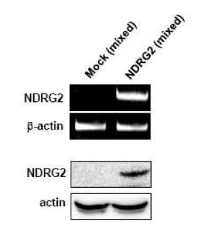 4T1 마우스 유방암 세포주에 NDRG2 transfection을 통한 과발현 세포주 생성