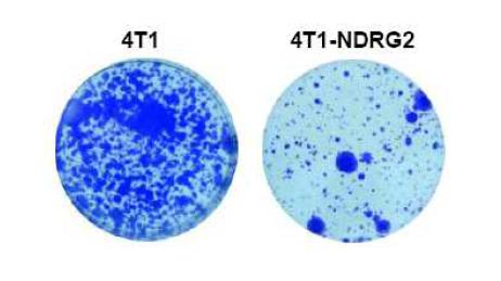 NDRG2 과발현에 의한 암세포 전이 억제 관찰