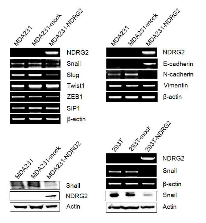 유방암 세포에서 NDRG2 발현에 의한 EMT marker의 변화