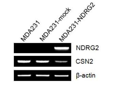NDRG2에 의한 CSN2 발현의 억제