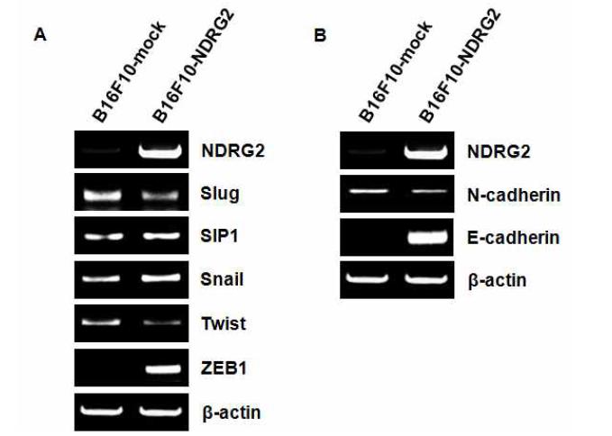 마우스 흑색종세포에서 NDRG2 과발현에 의한 EMT marker의 변화