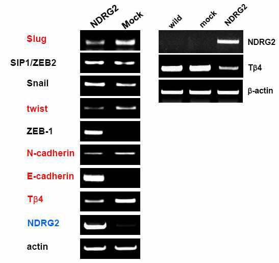 마우스 흑색종세포에서 NDRG2 과발현에 의한 thymosin β4 및 EMT marker의 변화