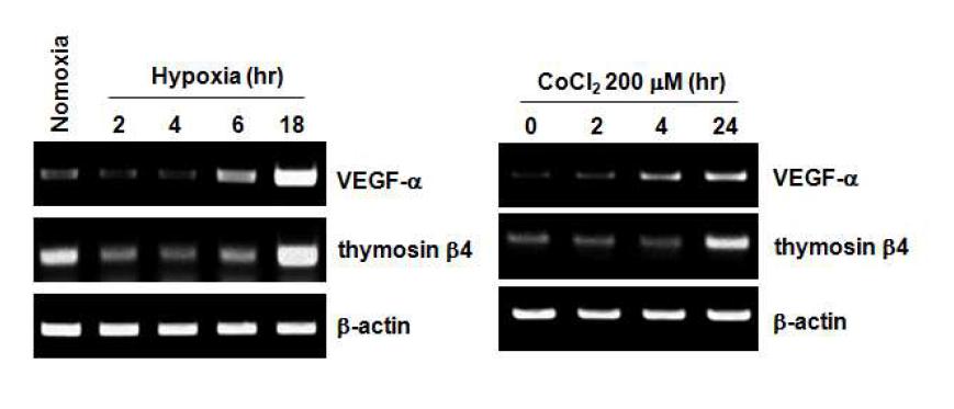 저산소 상태에서 thymosin β4과 VEGF-α 발현의 증가
