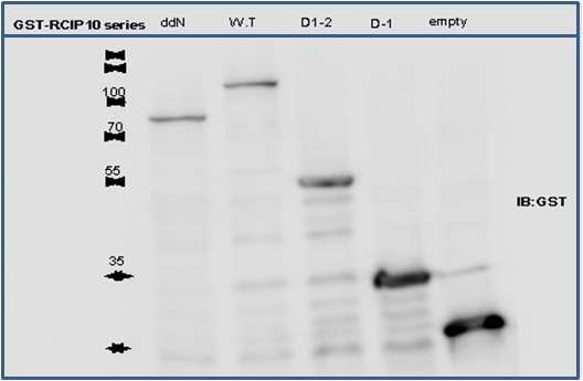 RCIP10의 Mutant cloning construct의 expression test 결과