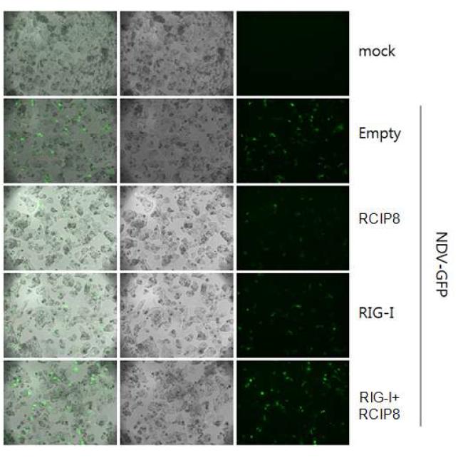 HepG2 세포주에 RIG-I, RCIP8 혹은 둘을 함께 transfection 시킨 뒤,GFP-NDV를감염시켜 바이러스의 증식 제어 효능을 GFP를 통하여 측정.