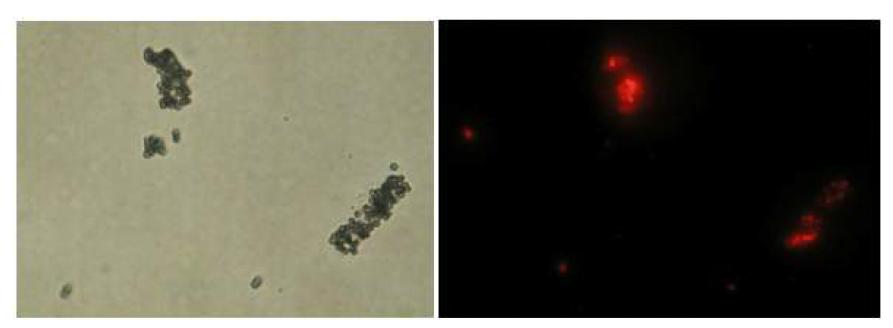 큰 PSQ-GNP-DNA1 및 작은 형광 PSQ-GNP-DNA1의 혼합물 (왼쪽)일반모드, (오른쪽) 형광모드 현미경 이미지
