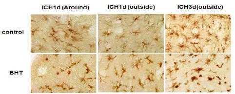 Iba-1 immunohistochemistry