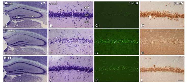 Neuroprotective effect of mBHT against global ischemic injury on CA1 neuronal cell death of gerbil brains.