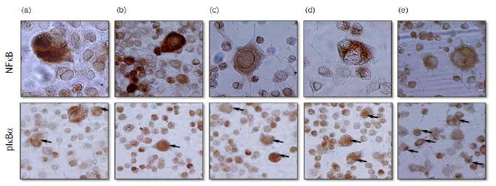 Effects of mBHT on H2O2-induced subcellular localization of NF-κB-IkBα.