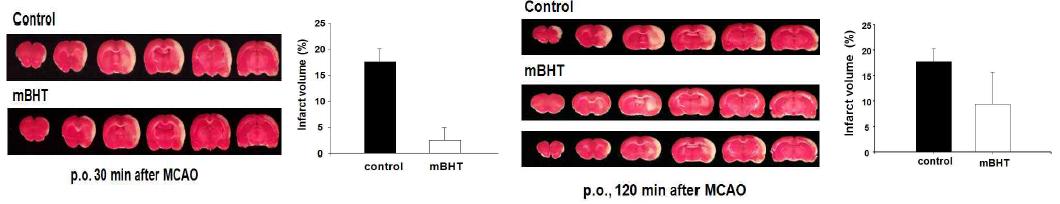 mBHT는 전처리, 복강투여 시 뇌경색의 부피를 감소시킴.