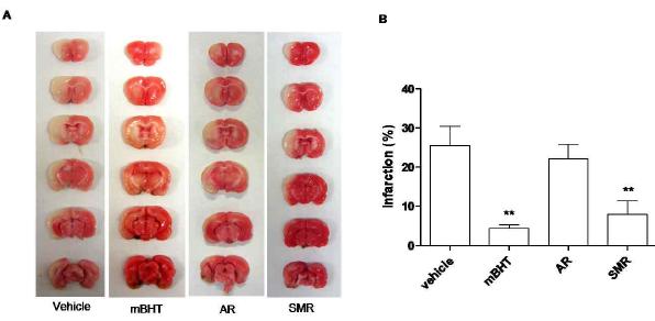 Effects of the mBHT, AR and SMR on infarct volume in ischemic hemisphere.