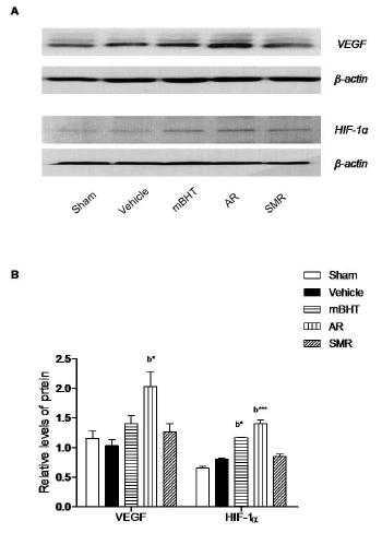 Effects of the mBHT, AR and SMR on the expressions of angiogenic molecules in ischemic hemisphere.