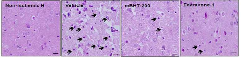 Histological profiles of ischemic brain by H&E staining. Non-ischemic H,